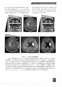 磁共振成像技术指南：检查规范、..._2