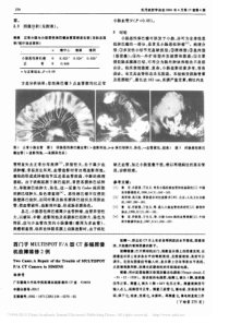 西门子MULTISPOTF_A型CT多幅照像机故障维修2例