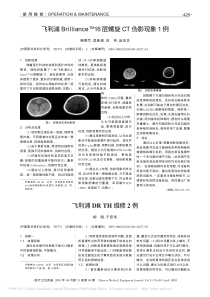 飞利浦Brilliance_TM_16层螺旋CT伪影现象1例