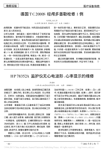 HP78352A监护仪无心电波形_心率显示的维修
