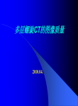 多层螺旋CT图像质量PP-1NEW