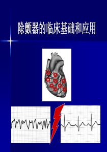 除颤器的临床基础和应用 