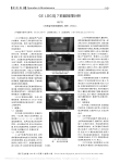 GELOGIQ7彩超故障分析